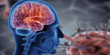Cuba socialiste développe un médicament contre Parkinson mais est freiné par le blocus