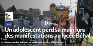 À Lens les violences policières arrachent le bras d&rsquo;un  jeune de 15 ans touchés par une grenade #lycéens #lycées  [Communiqué PRCF Lens]